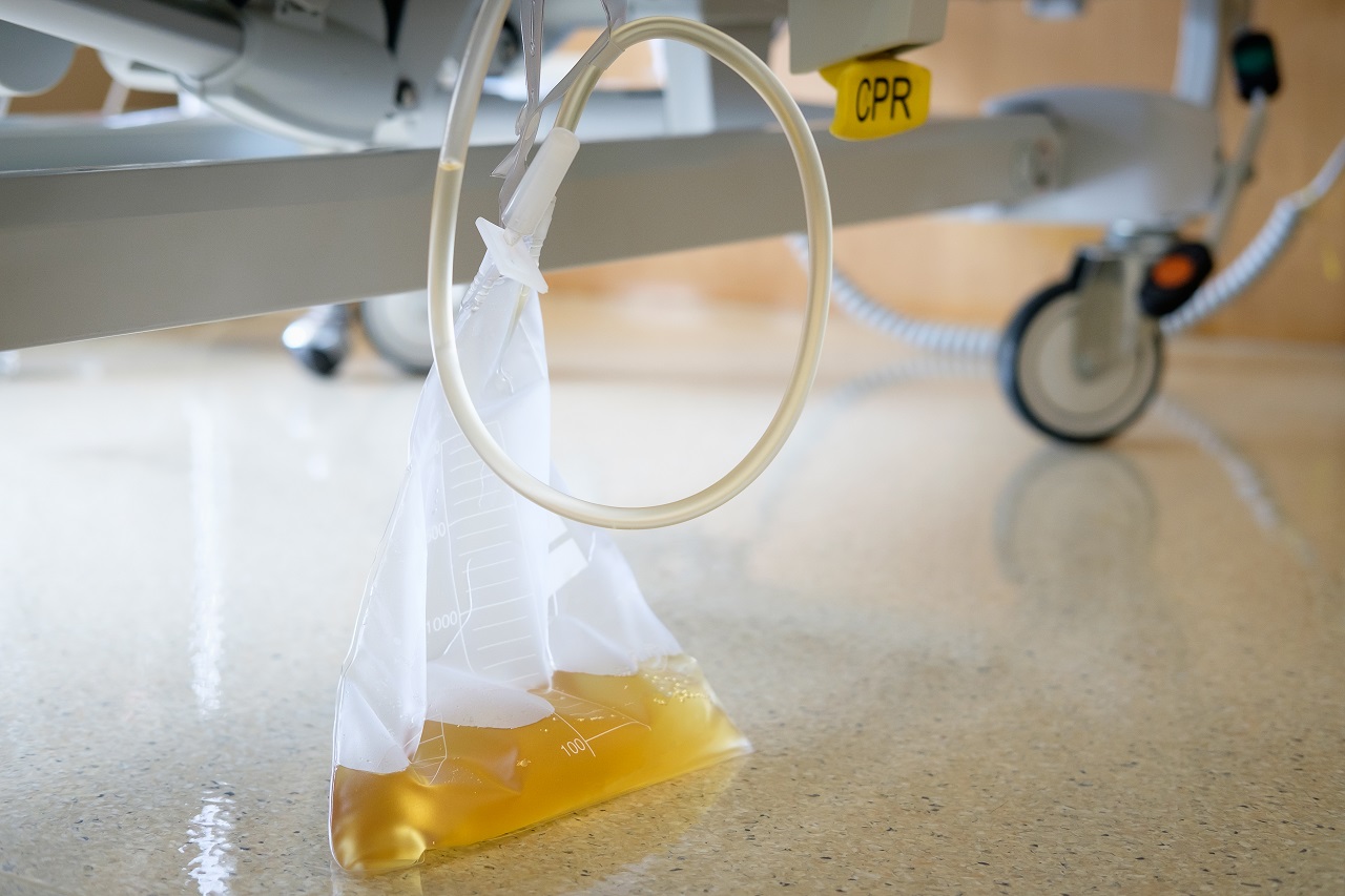 A plastic urine collection bag in a hospital room