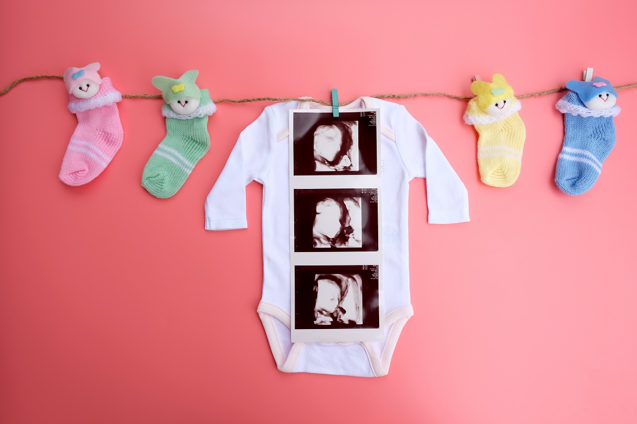 Baby clothes with 4D ultrasound pictures on top