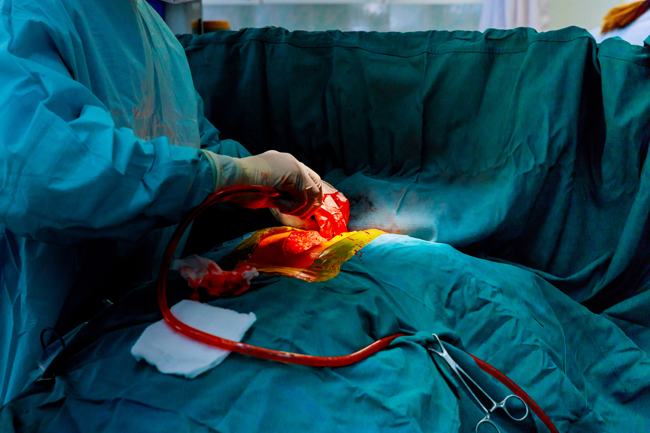 Surgery on a patient's heart