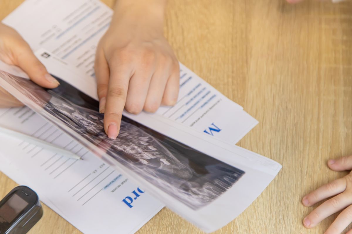 Accepting The Diagnosis