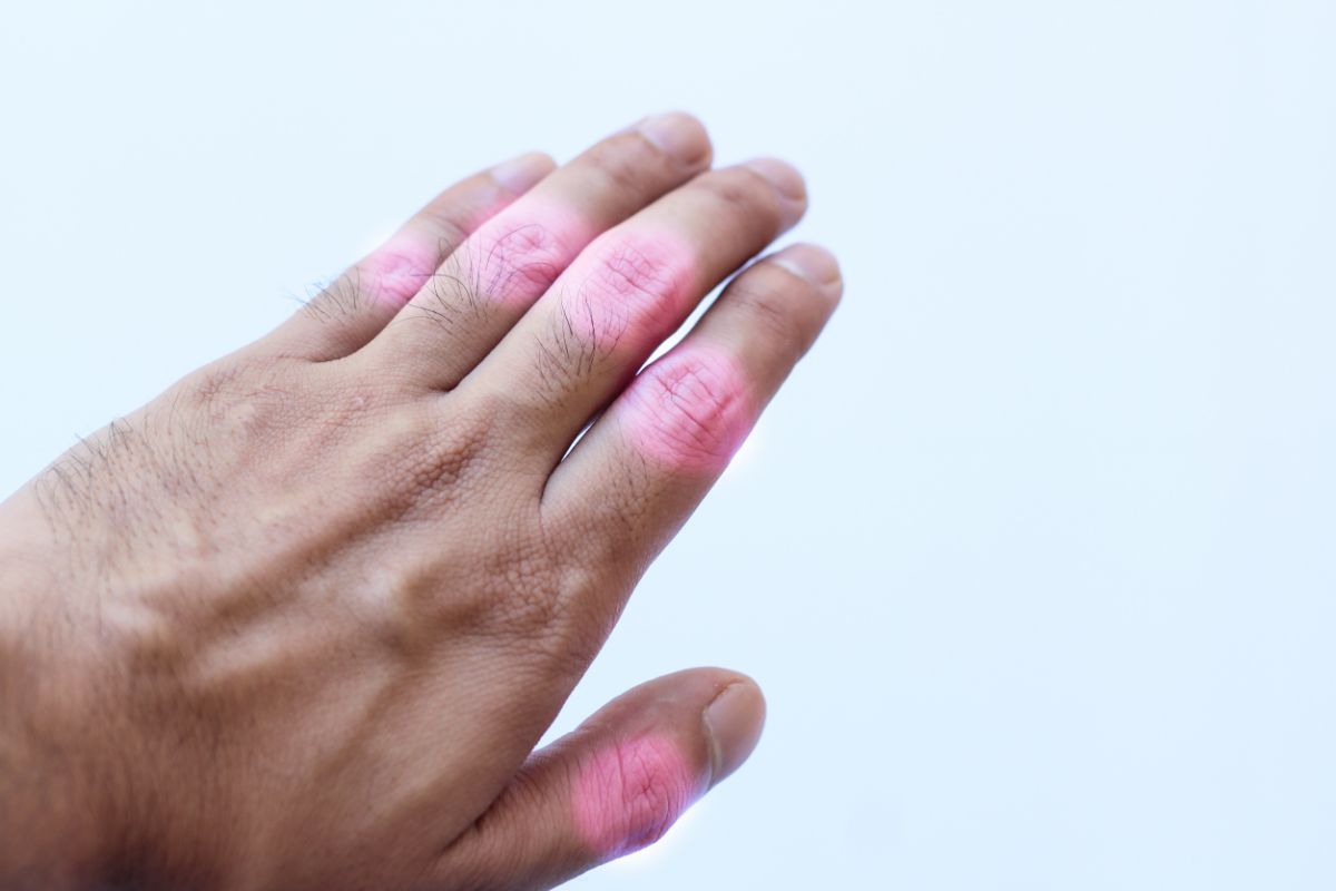 What is Arthritis and How Can You Avoid It?