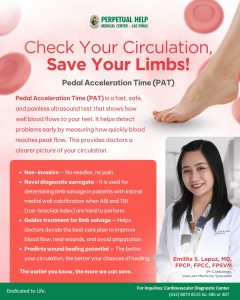 Pedal Acceleration Time